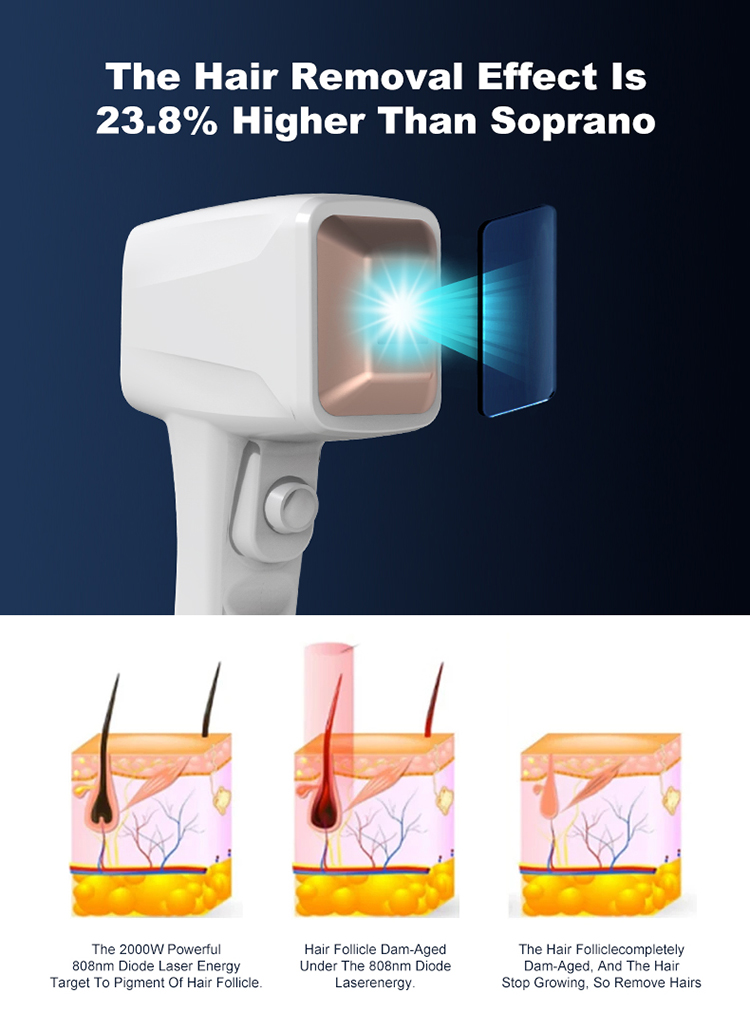 808nm hair removal device09